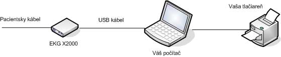 ekg-pc ekg-pc